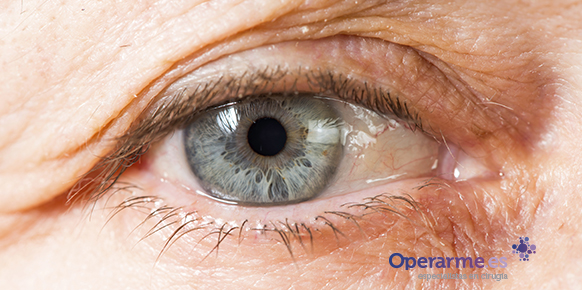 cirugia-de-cataratas-con-lio