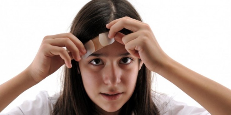 kopfverletzung-870x435