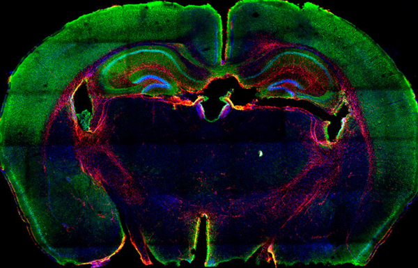 mas-cerca-del-tratamiento-personalizado-del-cancer_full_landscape