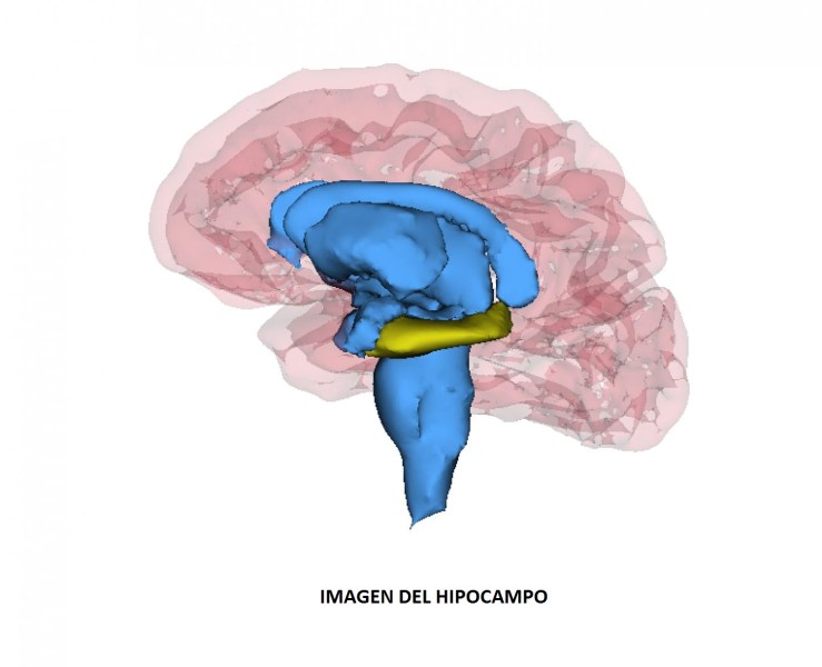 Los-pacientes-con-depresion-recurrente-tienen-un-hipocampo-mas-pequeno