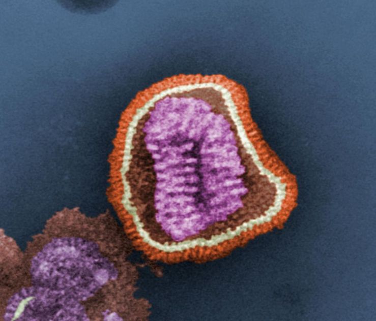 1024px-Influenza_virus_particle_color